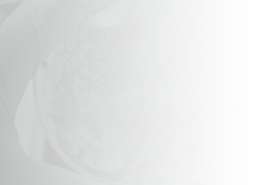 Petri dish with microbial growth
